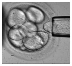 Ann Arbor -- University of Michigan researchers say they've discovered a genetic lack of diversity in some of the most used human embryonic stem cell lines.